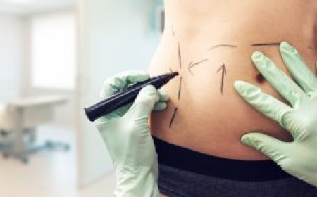 What Makes Abdominoplasty Dubai So Popular Among Expats?