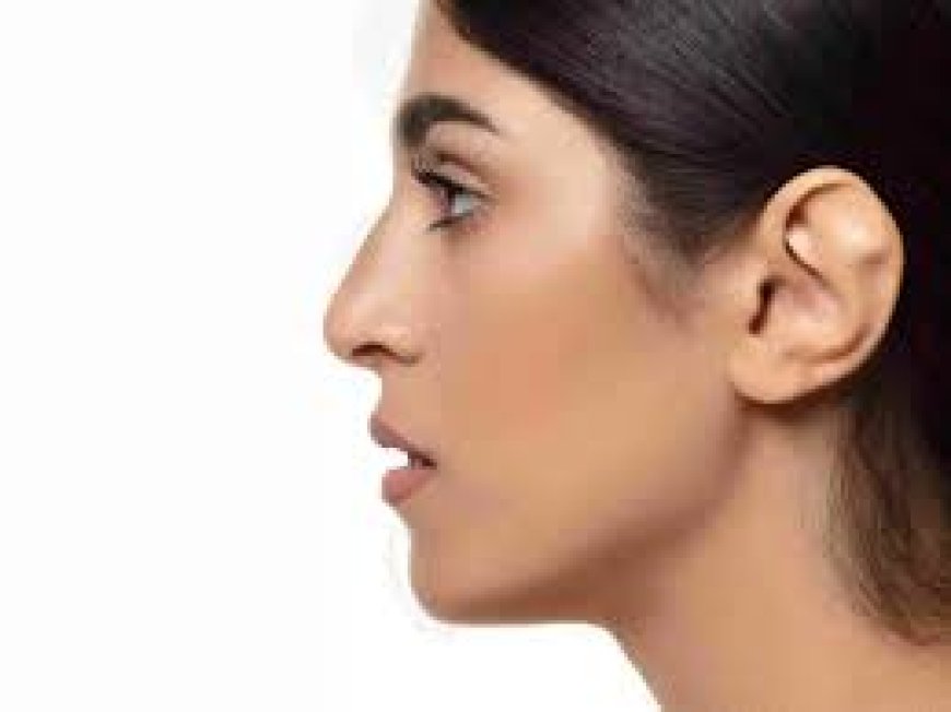 Otoplasty in Jeddah: Reshape Your Ears for a Balanced and Natural Look