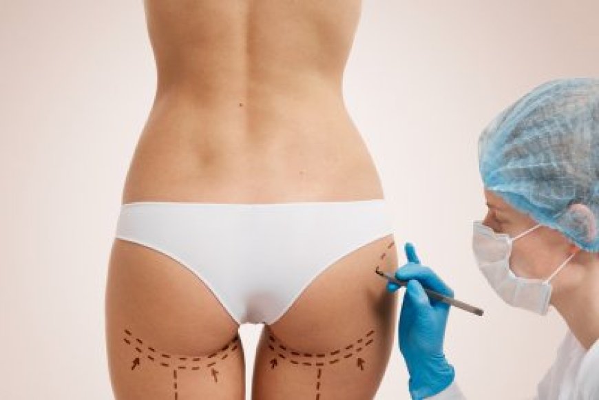How Butt Fat Transfer in Dubai Can Enhance Your Body Proportions Naturally