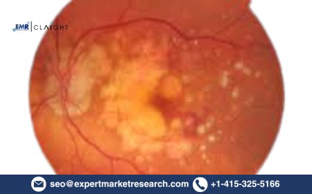 Age-related Macular Degeneration Market Size & Forecast 2034