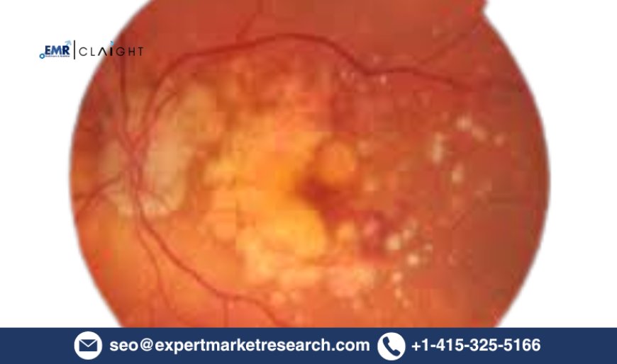 Age-related Macular Degeneration Market Size & Forecast 2034
